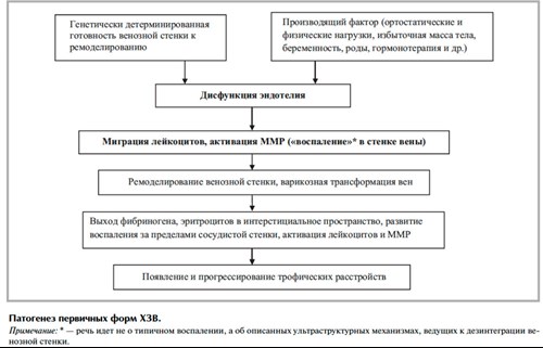 Хронические заболевания вен