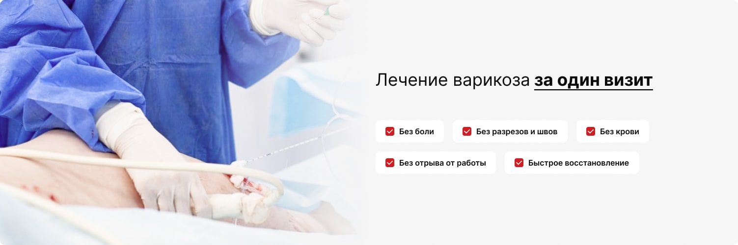 Лечение тромбоза Эндовенозной облитерацией. Без госпитализации.