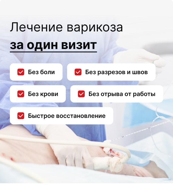 Лечение тромбоза Эндовенозной облитерацией. Без госпитализации.