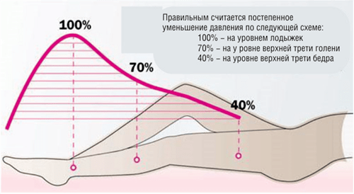 Распределение давления в ногах